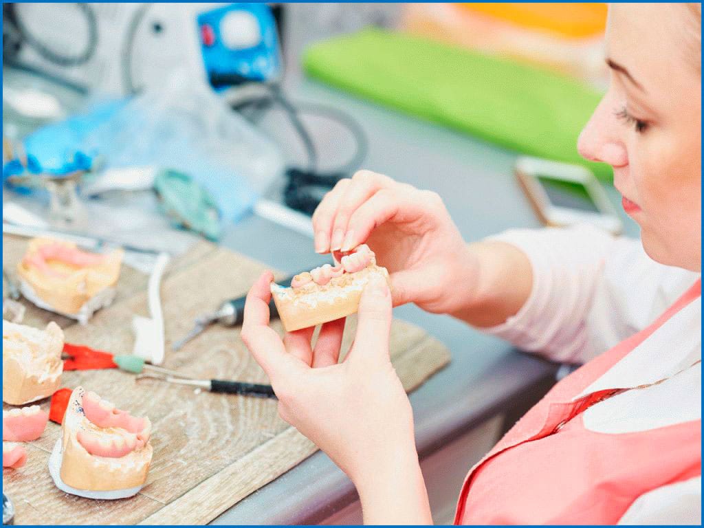 Процесс изготовления зубного протеза: объяснение этапов изготовления зубного протеза, включая снятие оттиска, цифровое сканирование, моделирование и окончательную фиксацию протеза.