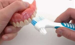 Уход за зубными протезами: рекомендации по правильному уходу за зубными протезами, включая чистку, снятие и промывание протезов, использование специальных очищающих средств и советы по поддержанию их долговечности и гигиены