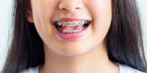 Раннее ортодонтическое вмешательство: Возможности и польза для детей
